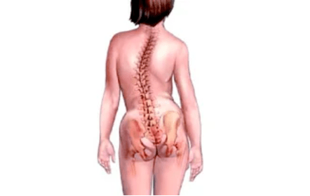 The reasons for the development of cervical osteochondosis