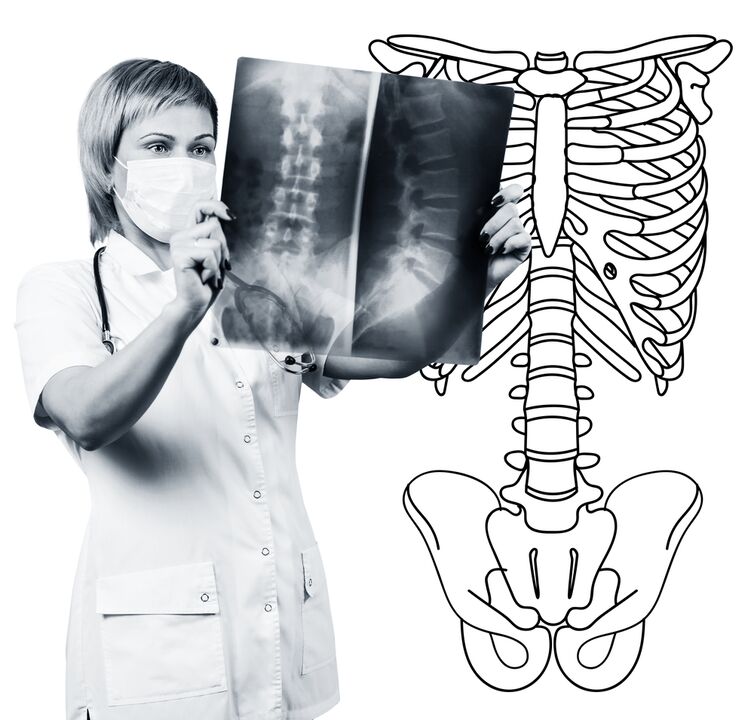 Radiography of the lumbar column