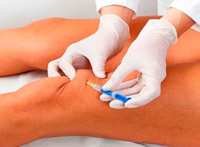 Intra-articular injections of drugs for osteoarthritis of the knee joint