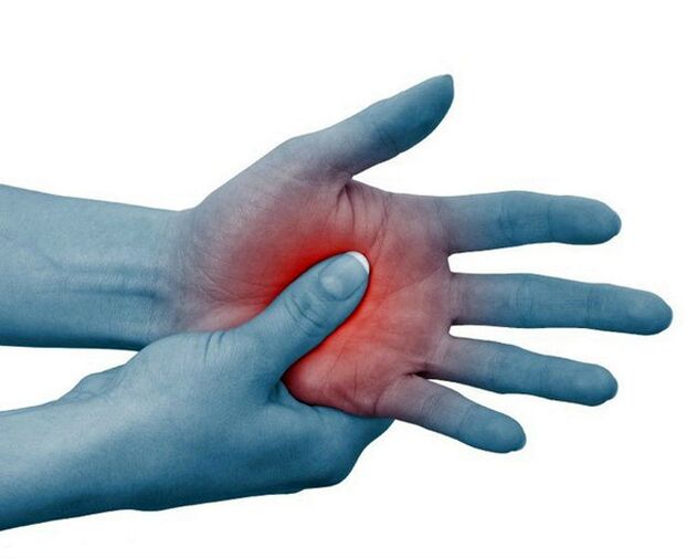 Severe pain in the finger joints, decreasing with exercise, is a typical sign of rheumatoid arthritis. 